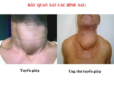 Bài giảng Sinh học 8 - Nội tiết